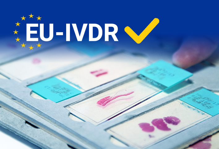 New regulation (EU) 2017/746 on in vitro diagnostic products (IVDR)