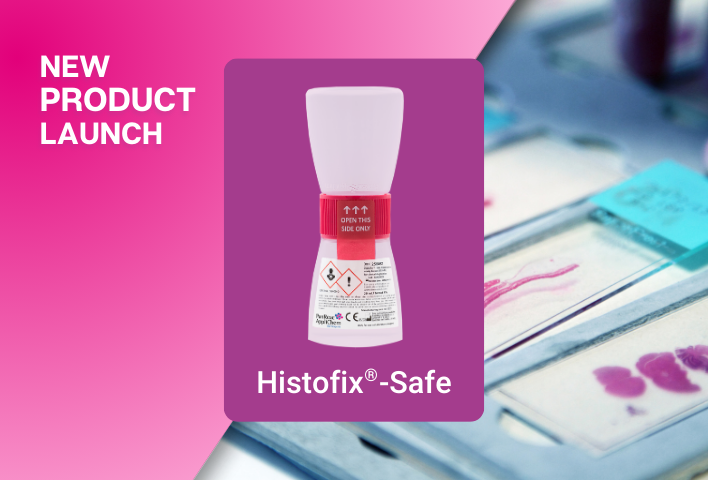 Histofix®-Safe: Nuevo dispositivo CE-IVD para la fijación de biopsias para Diagnóstico Clínico